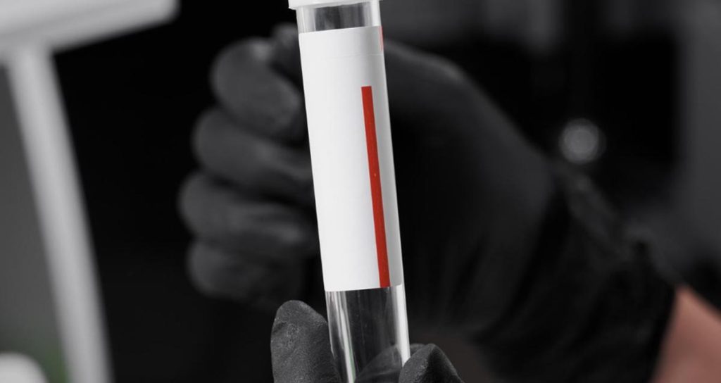 HIV Testing - Dr. Jasdeep Sidana